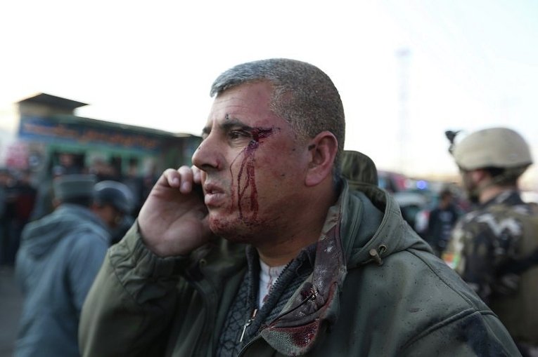 Раненный мужчина на месте взрыва неподалеку  от аэропорта Кабула (Афганистан)