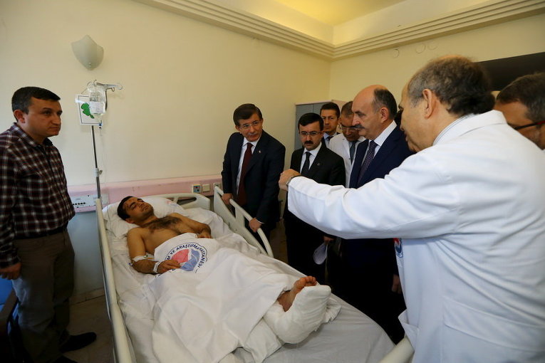Премьер-министр Турции Ахмет Давутоглу в сопровождении министра здравоохранения посещает жертву бомбардировки в больнице в Анкаре