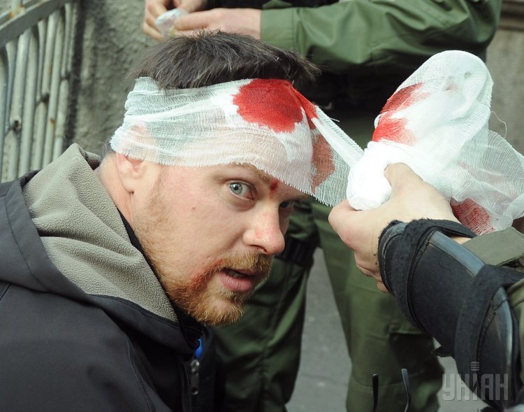 Пострадавший во время столкновений под Администрацией президента в Киеве фотокреспондент Reuters Валентин Огиренко