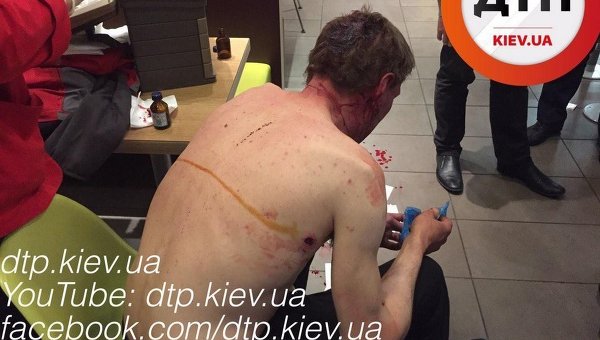 Окровавленный мужчина в Киеве