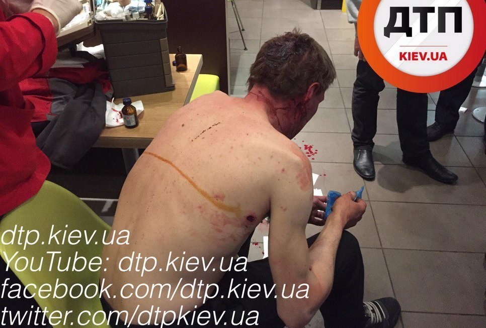 У Києві поранений чоловік сховався від вбивць в "Макдональдсі" - фото 3
