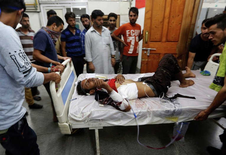 Пострадавший в ходе беспорядков в индийском Кашмире