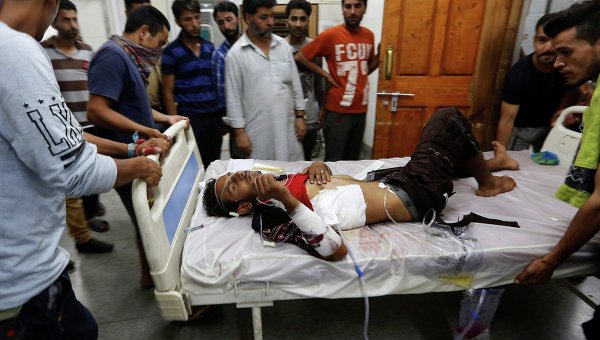 Пострадавший в ходе беспорядков в индийском Кашмире