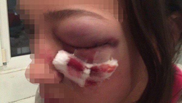 В луцком торговом центре группа подростков жестоко избила школьницу