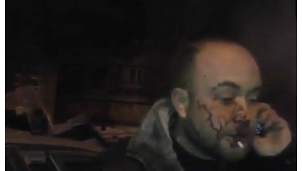 Раненный во время обстрела Донецка мужчина