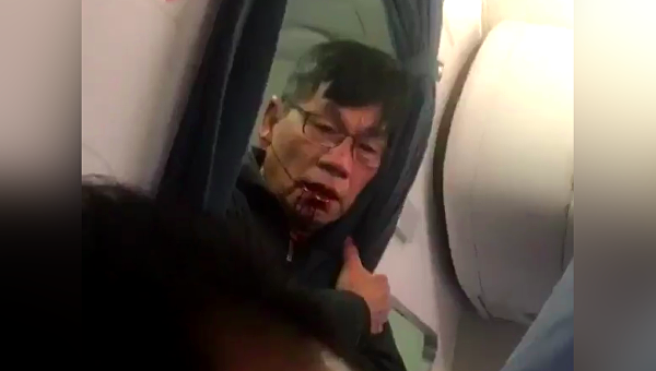Пассажир, пострадавший от рук охраны United Airlines