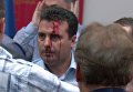 Избитый во время захвата парламента Македонии оппозиционер Зоран Заев