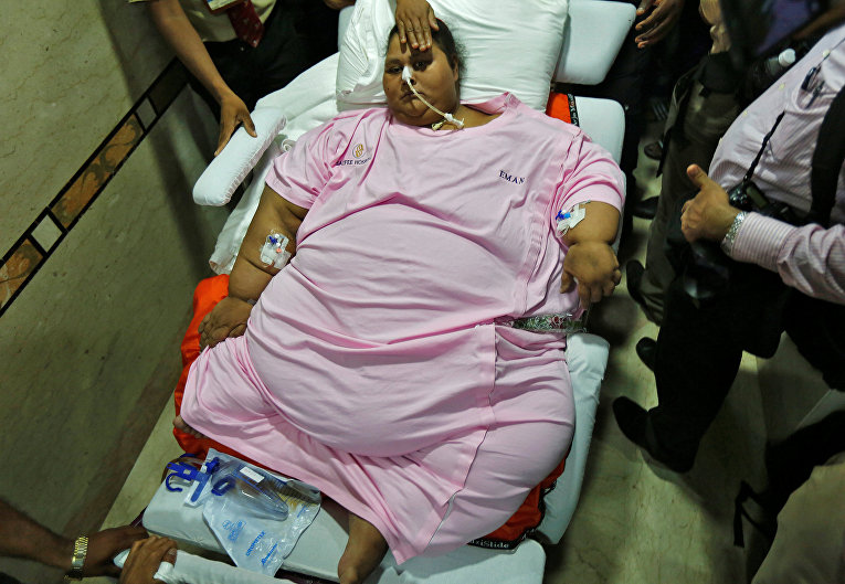 Египтянка Иман Ахмед Абдулати, которая считалась самой тяжелой женщиной мира и весила около 500 килограммов, в ходе курса лечения в индийской клинике города Мумбаи похудела до 171 килограмма.