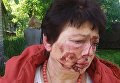 Избиение председателя территориальной избирательной комиссии (ТИК) Людмилы Демченко в поселке Коцюбинское под Киевом