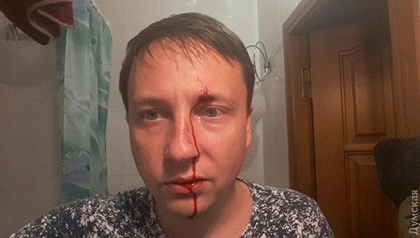 Нападение на депутата Черноморского городского совета от партии Возрождение Дмитрия Гапоненко, 4 июля 2017