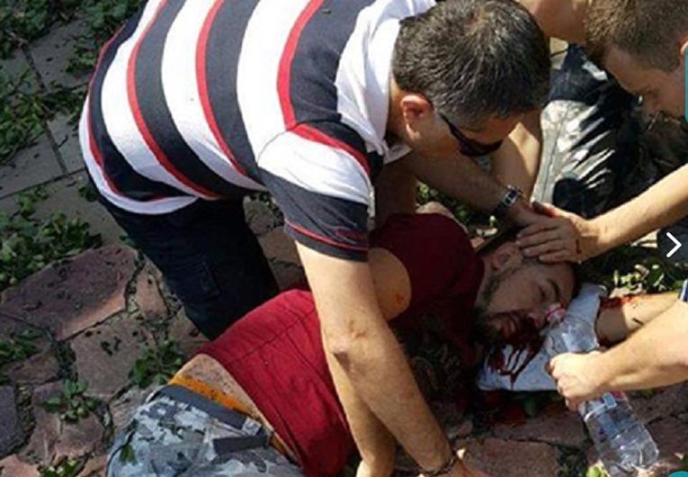 В одном из парков Киева. От старой груши отломилась ветка и упала на четверых прохожих.Больше всего пострадал иностранец — спасатель из Турции.