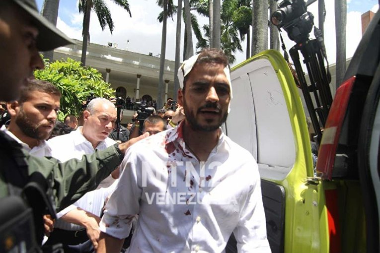Пострадавшие во время захвата парламента Венесуэлы
