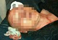 В Ровно гражданин Азербайджана сильно избил бойца АТО из-за девушки