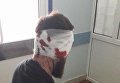 Избиение Дмитрия Булаха в Харькове