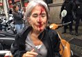Референдум в Каталонии. Одна из пострадавших в результате действий полиции