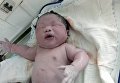 Во Вьетнаме родился ребенок-гигант, весом более 7 кг