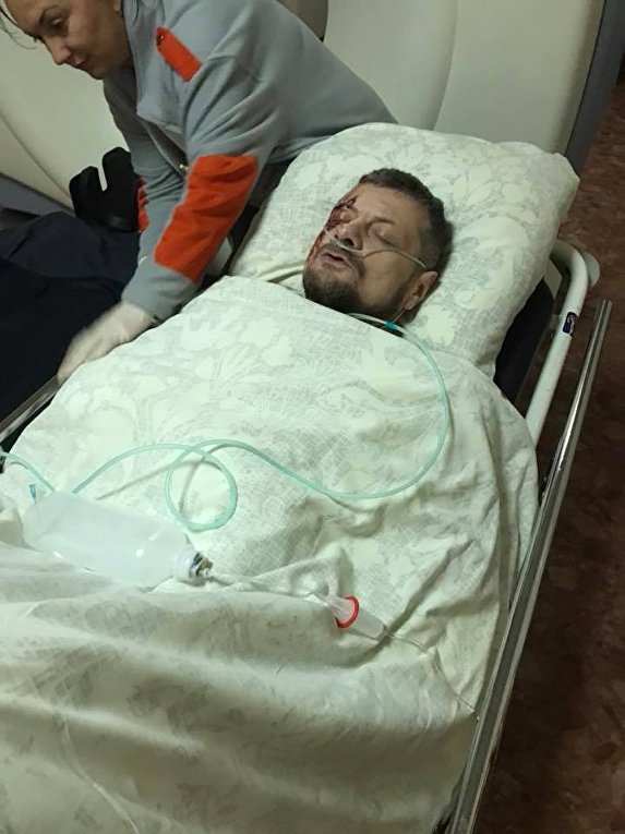 Игорь Мосийчук в больнице после подрыва авто