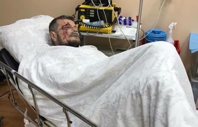 Нардеп от Радикальной партии  Игорь Мосийчук, раненный в результате взрыва в Киеве