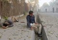 Пострадавший ждет помощи после взрыва в Кабуле