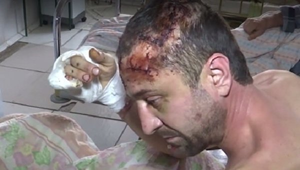 Мужчина, пострадавший в результате пыток, в Житомирской области