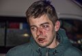 В центре Киева работники ресторана жестоко избили своих же клиентов