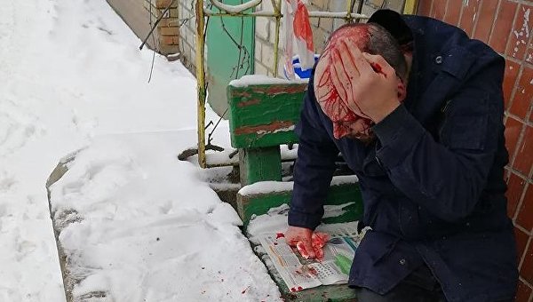 Мужчина, пострадавший в результате нападения в центре Киева