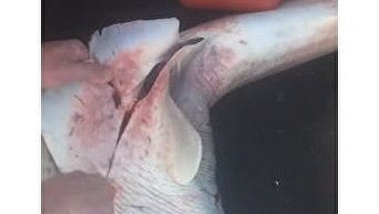 Рыбак сделал кесарево сечение акуле и спас детенышей. Видео
