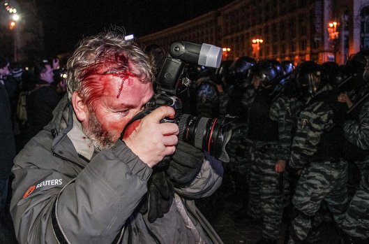 Раненый фотокорреспондент Reuters Глеб Гаранич во время разгона Евромайдана в ночь на 30 ноября