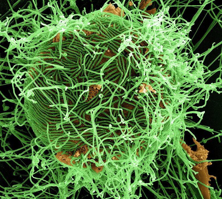 Распространение вируса Эбола в мире (зеленым цветом отмечены нитевидные частицы вируса Эбола)