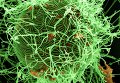 Распространение вируса Эбола в мире (зеленым цветом отмечены нитевидные частицы вируса Эбола)