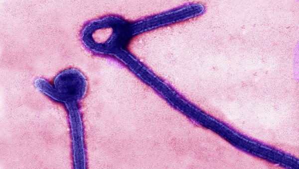 Вирусные частицы лихорадки Эбола