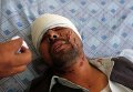 Пострадавший в теракте в Кабуле