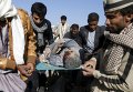 Раненый в результате авиаудара по Йемену