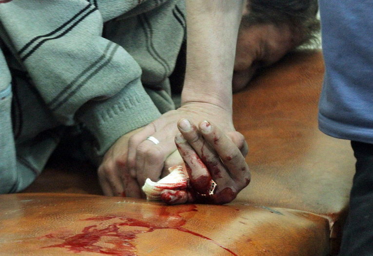 Мужчина в полевом госпитале держит за руку пострадавшего после ударов с воздуха недалеко от Дамаска