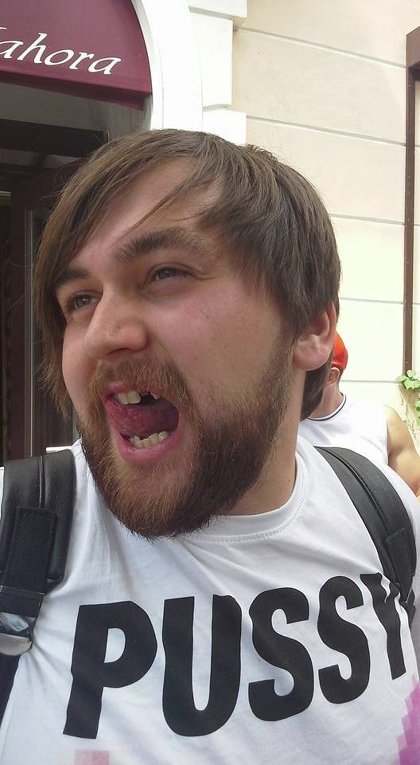 Блогеру Барабошко выбили зуб во время драки в Чернигове