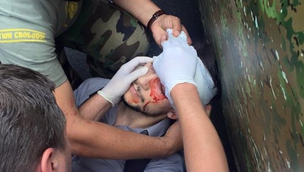 Журналист французского издания Finance ранен в результате беспорядков у здания Верховной рады Украины