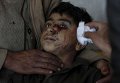 Пострадавший ребенок в больнице Пешавара - административном центре пакистанской провинции Хайбер-Пахтунхва
